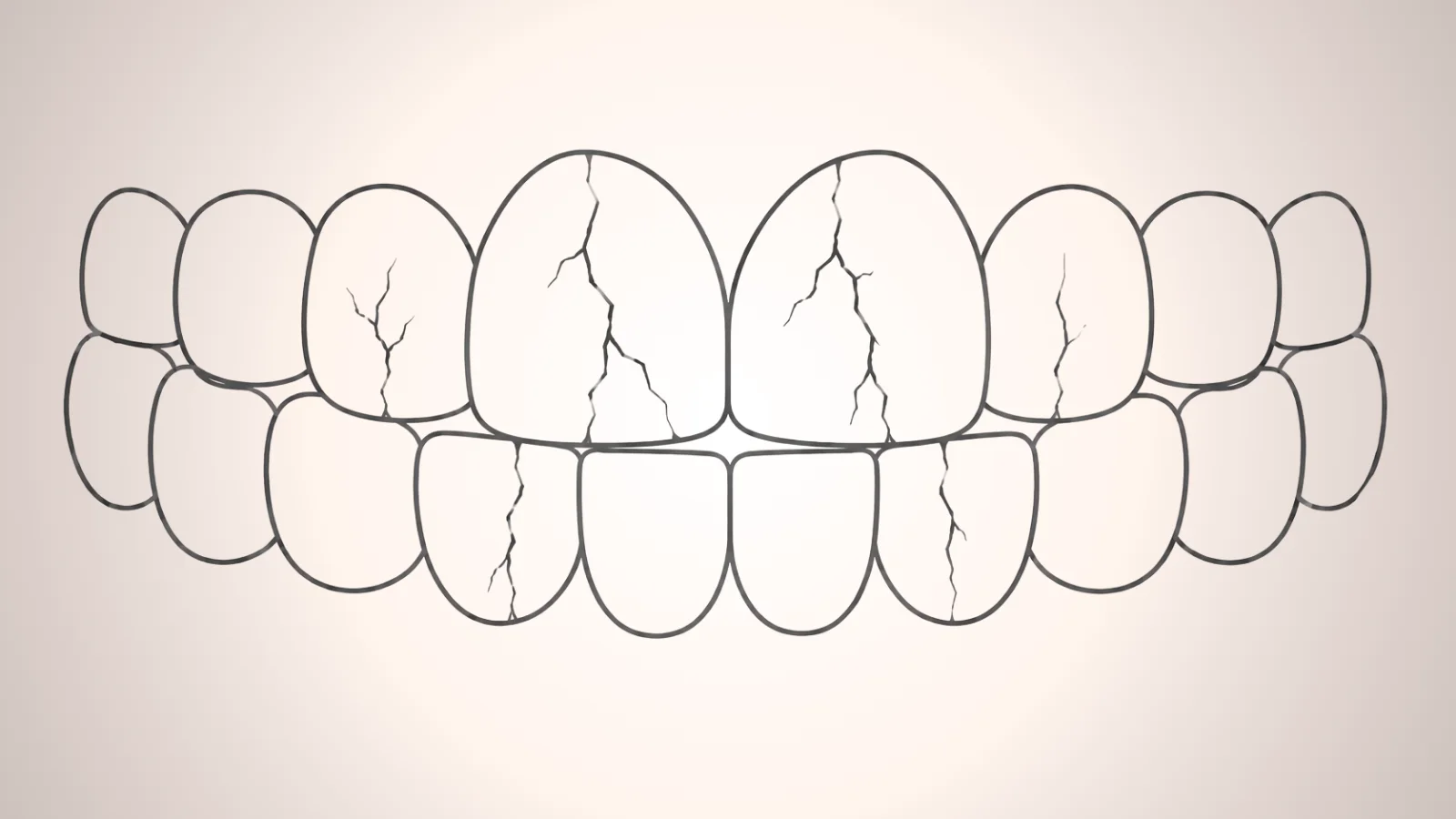 ภาพกราฟฟันแตกร้าว